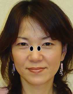 l̊Aʂ