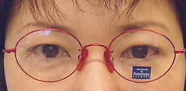 調整前顔写真